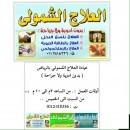 العلاج بلسع النحل