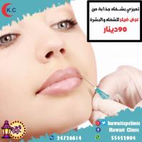 أقوى عروض عيادة تجميل بالكويت | مستوصف الكويت التخصصي