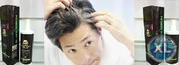 أقضى على الشعر الابيض بلاك سيرم سبراى01066597532