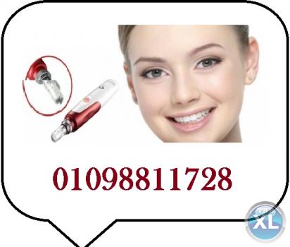 ديرما بن هو العلاج النهائي لحفر الوجه والندبات