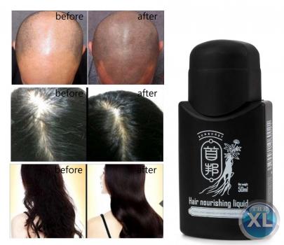 منتج سن برست لا نبات البصيلات الشعريه